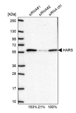 HARS Antibody, Novus Biologicals:Antibodies:Primary Antibodies